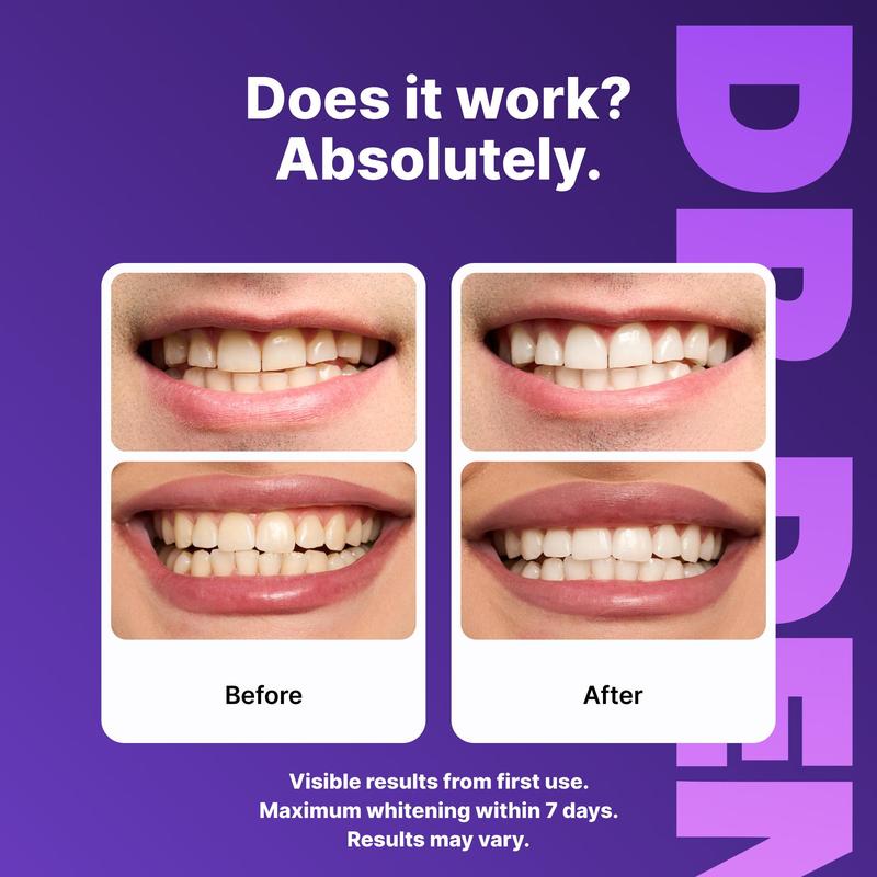 LUXWHITE™ Advanced Purple Sensitive Whitening Strips