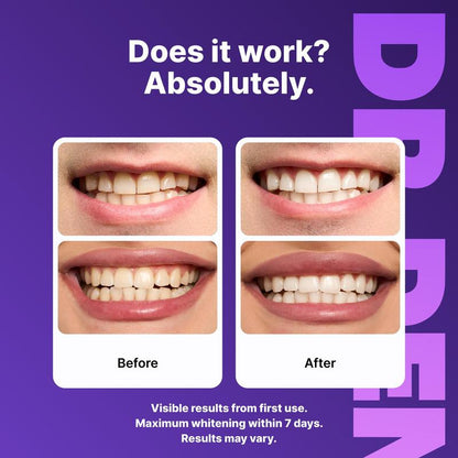 LUXWHITE™ Advanced Purple Sensitive Whitening Strips