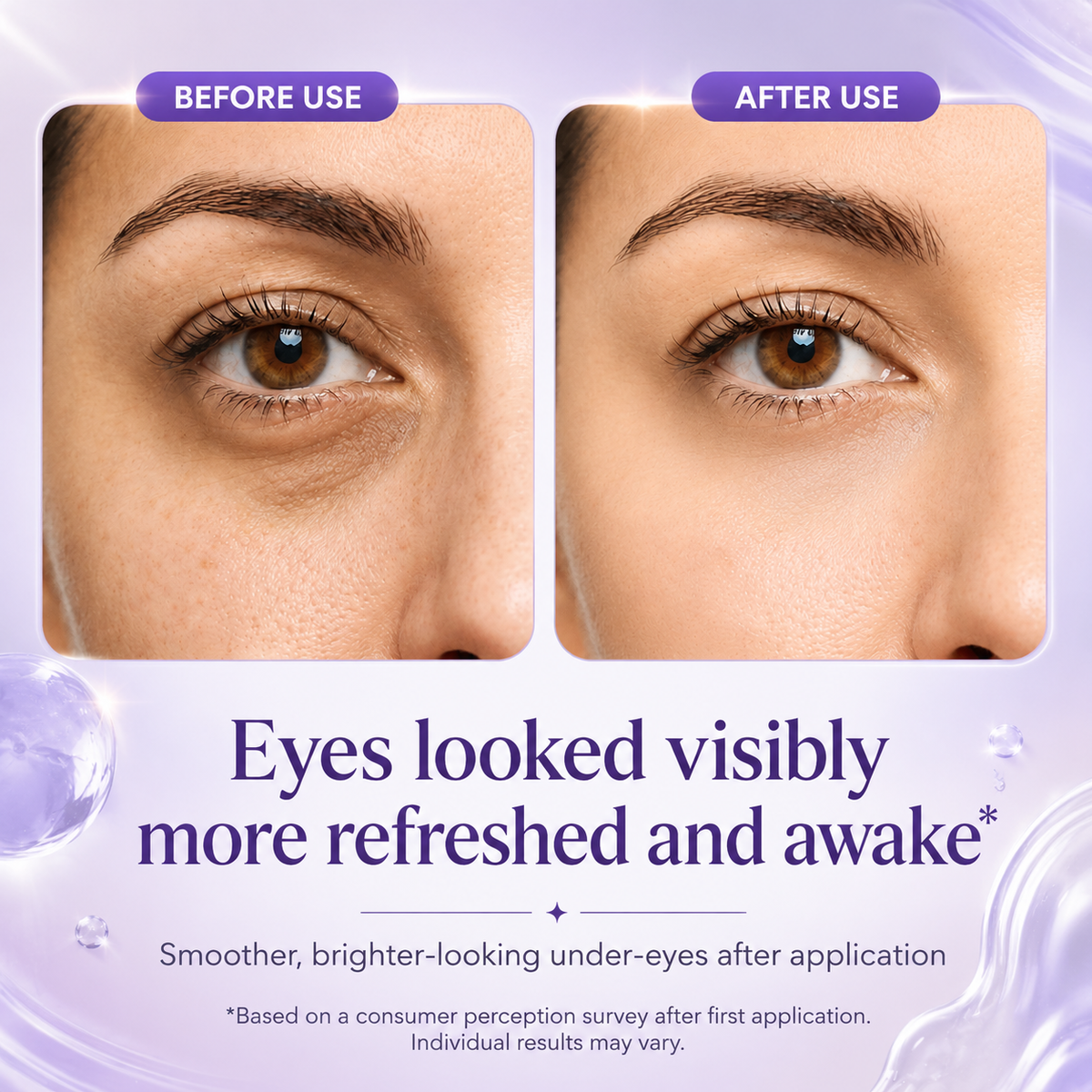 Instant Eye Tightener Gel | Reduce Eye Bags, Fine Lines & Wrinkles
