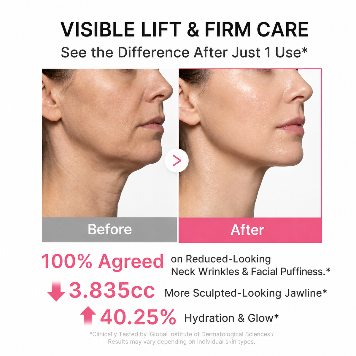 LUXFIRM Gua Sha - Neck & Face Lifter | PDRN Volufiline 5% Collagen Clinical Wrinkle Cream