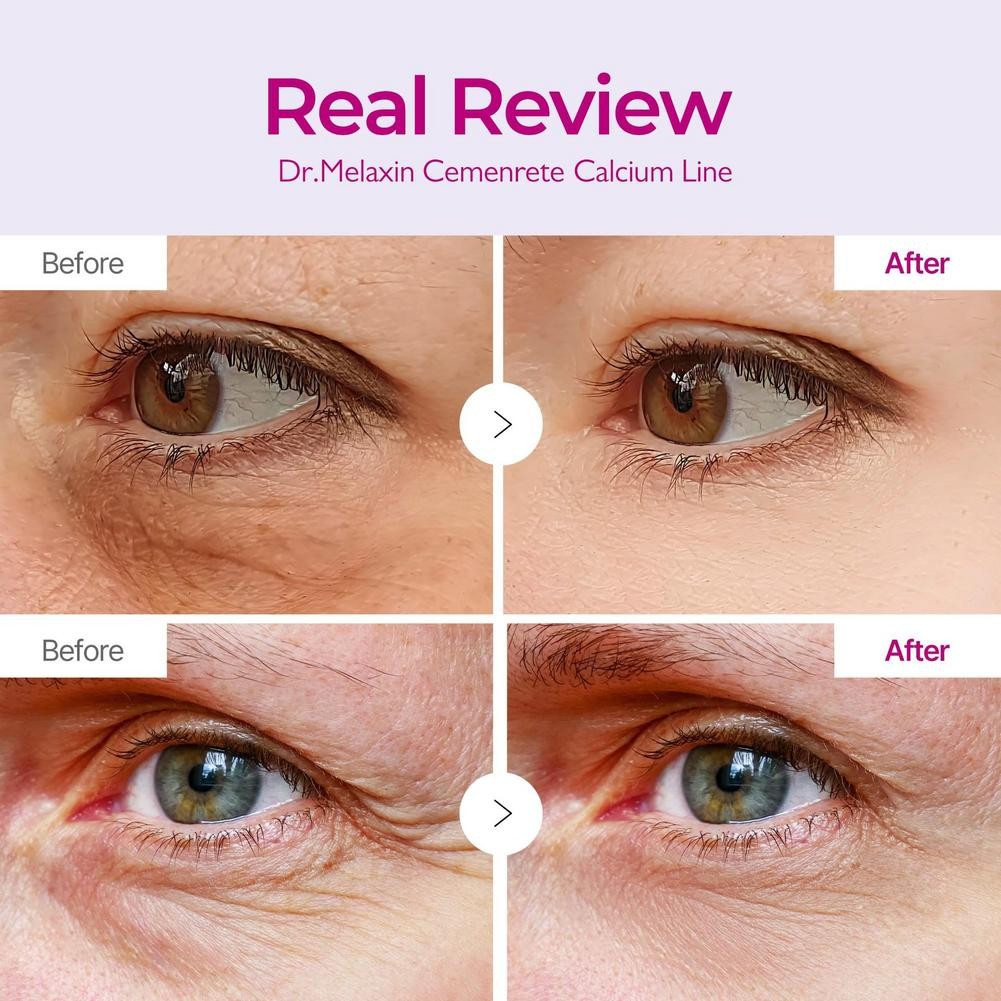 DR.MELAXIN CEMENRETE CALCIUM VOLUME MULTI BALM 9G